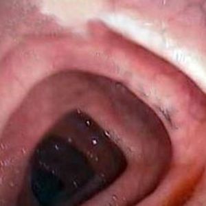 Meet your Posher, Jerry